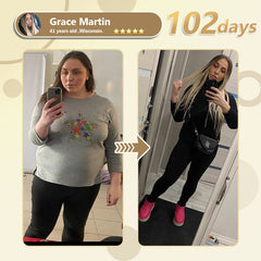 ๐ฅODALITโข Nano microneedle slimming patch๐ฅ