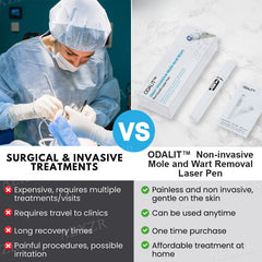 š„LAST DAY 49% OFF -ODALIT⢠Non-Invasive Mole and Wart Removal Laser Penš„ļ¼åÆę¬ļ¼