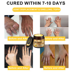 🐝💎Time-Limited Offer - Negusy™ Botulinum Toxin & Bee Venom Pain-Relief Bone Healing Cream🐝💎