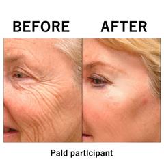 🌟ODALIT™Natural wrinkle removal