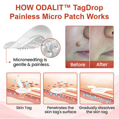 🔥💥ODALIT™ painless micro-patch