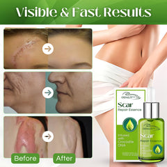 ODALIT™ Scar Repair Essence (SALE ENDS IN 10 MINUTES)